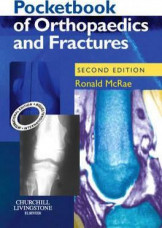 Pocketbook Of Orthopaedics And Fractures 2Nd Ed