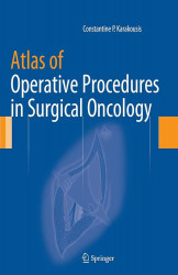 Atlas Of Operative Procedures In Surgical Oncology
